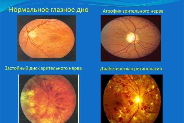 Кракен тор ссылка сегодня